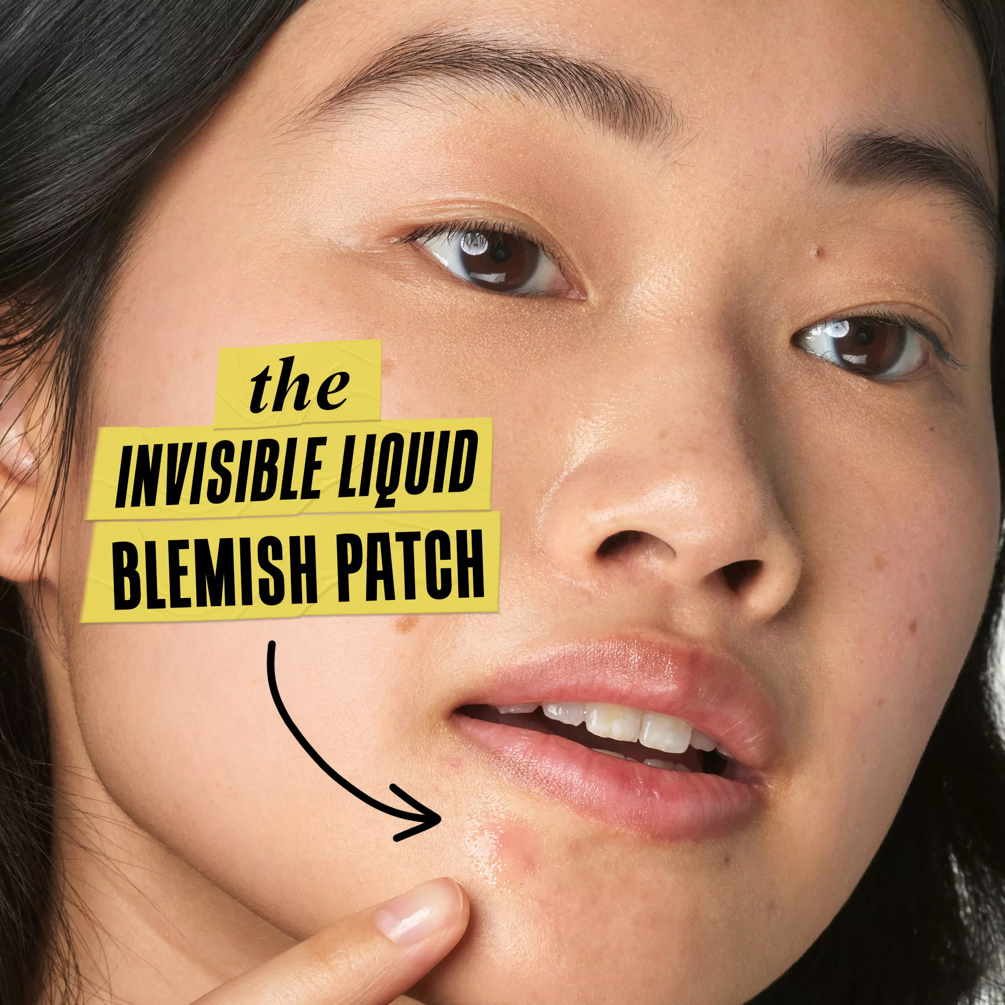 Truly Targeted Blemish-Clearing Solution